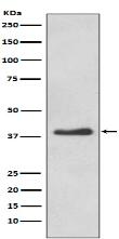 Mast Cell Tryptase Antibody