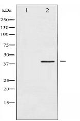 HDAC8 Antibody