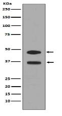 Fos B Antibody