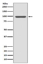 Insulin Receptor Antibody