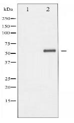 Phospho-Elk1 (Ser389) Antibody