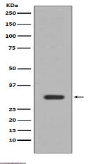 PIM1 Antibody