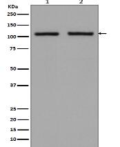 Hexokinase 1 Antibody