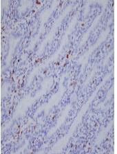 IBA1 Antibody