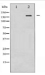 Phospho-EGFR (Tyr1092) Antibody