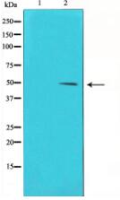 Phospho-Cyclin E1 (Thr395) Antibody