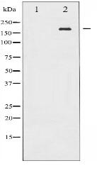 Phospho-EGFR (Tyr869) Antibody