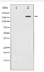 Phospho-ASK1 (Ser966) Antibody