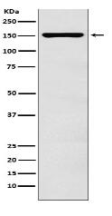 ADAR1 Antibody