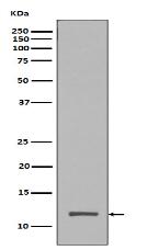 Histone H4 (tri methyl K20) Antibody