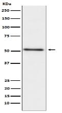 Prostatic Acid Phosphatase Antibody