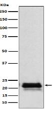 FSH beta （FSHB） Antibody