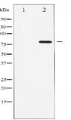 Phospho-ATRIP (Ser68) Antibody