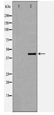 Phospho-Dematin (Ser403) Antibody