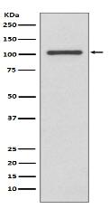 INPP4B Antibody