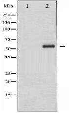 Phospho-Elk1 (Ser383) Antibody