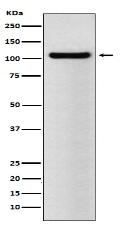 BRD2 Antibody