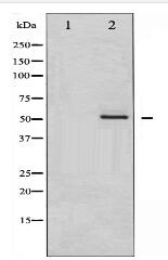 MEF2A Antibody