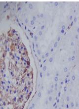 Nestin Antibody