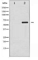 Phospho-Chk2 (Thr383) Antibody