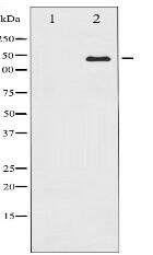 Calcium Sensing Receptor Antibody