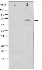 Phospho-Catenin-β (Ser37) Antibody