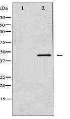 SEK1/MKK4 Antibody