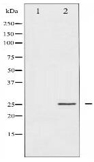 p21 Cip1 Antibody