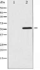 Phospho-ATF2 (Ser112 or 94) Antibody