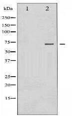 Phospho-Estrogen Receptor- alpha (Tyr537) Antibody
