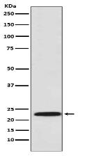 PSMB8 / LMP7 antibody