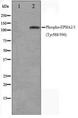 Phospho-EPHA2/3(Tyr588/596) Antibody