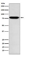 RANK Antibody