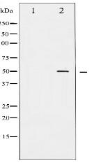 Phospho-AML1 (Ser303) Antibody