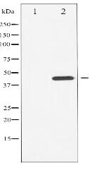 Phospho-Chk1 (Ser296) Antibody