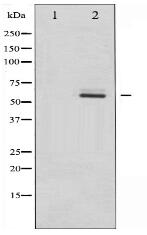 Estrogen Receptor-beta Antibody