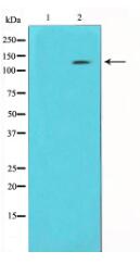 Phospho-EGFR (Ser1070) Antibody