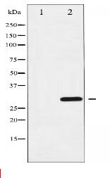 Cyclin D3 Antibody