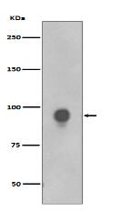 Phospho-RSK1 p90 (T359+S363) Antibody