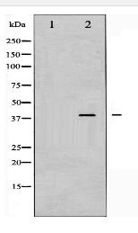 Phospho-AMPK β1(Ser181) Antibody