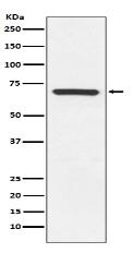 MEKK3 Antibody