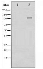 NF-kappaB p100/p52 Antibody