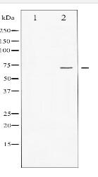 FOXO1A Antibody