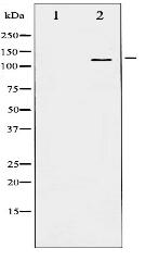 Phospho-B-RAF (Ser446) Antibody