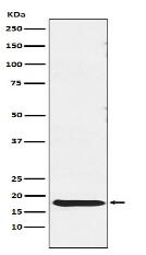 TSH beta Antibody