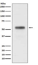 Retinoic Acid Receptor alpha Antibody