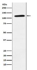 Eph receptor B1 Antibody