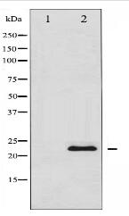 TIMP1 Antibody