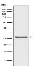 Phospho-Hsp27 (S82) Antibody