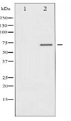 Phospho-Estrogen Receptor- alpha (Ser104) Antibody